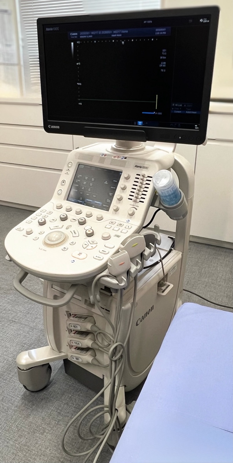 心エコー検査機器